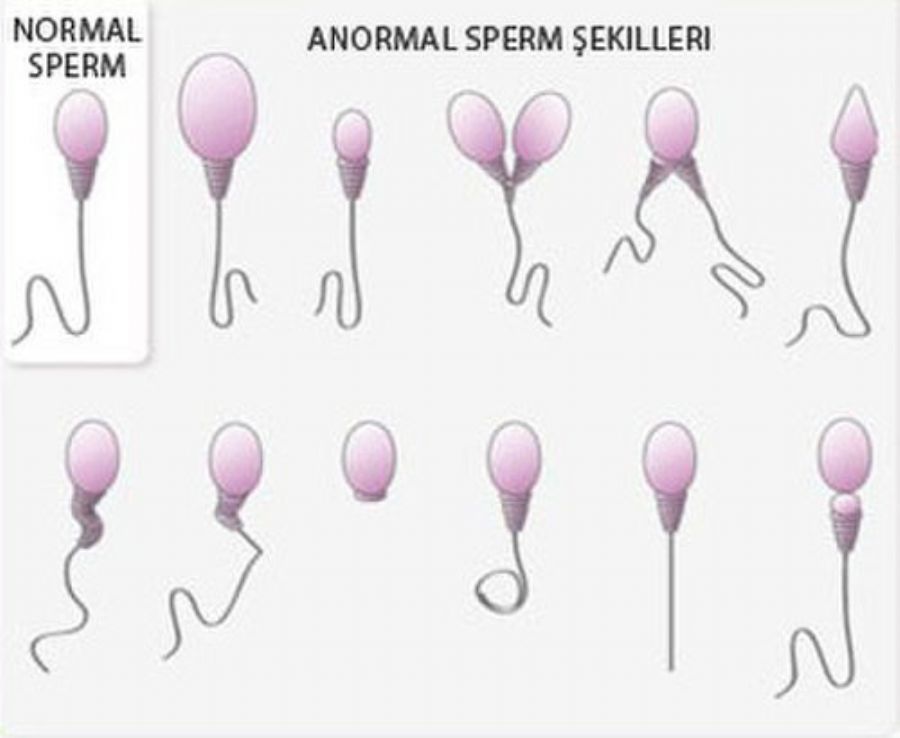 Sperm arttırıcı bitk